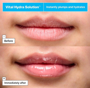 Dr.Jart+ Vital Hydra Solution Hydrating Lip Mask Pink 20ml - | SKNLÛX