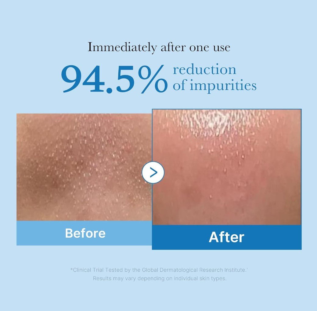 Medicube Zero Pore Blackhead Cleansing Oil 205ml - | SKNLÛX