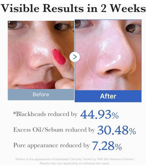Medicube Zero Pore Pad 155ml (70 pads) - | SKNLÛX