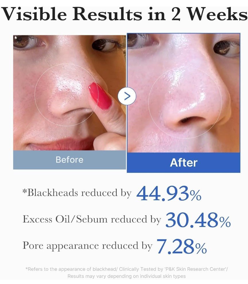 Medicube Zero Pore Pad 155ml (70 pads) - | SKNLÛX