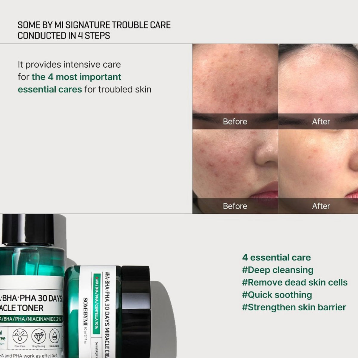SOME BY MI AHA-BHA-PHA 30 Days Miracle Starter Kit 4-Delar
