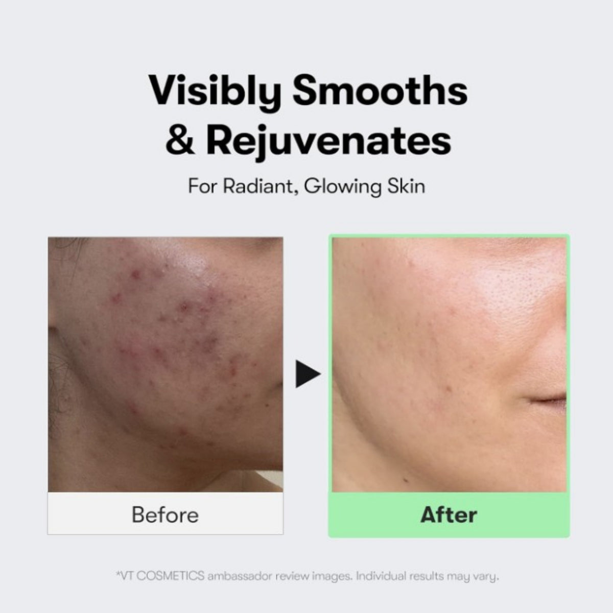 VT Cosmetics Reedle Shot 50 50ml