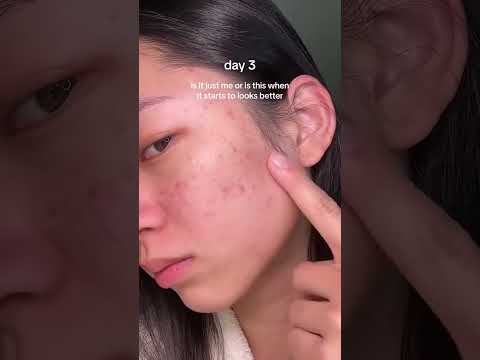 Anua Niacinamide 10% + TXA 4% Serum 30ml