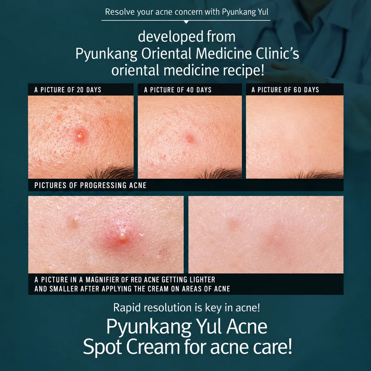Pyunkang Yul Acne Spot Cream 15ml
